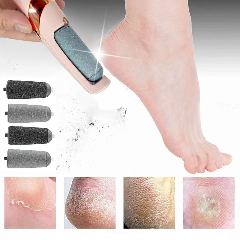 Soft Feet® Removedor de Calos e Esfoliador para Pés Macios | Davorah