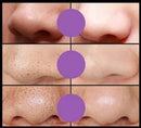 Máscara Facial Removedora de Cravos e Limpeza Profunda da Pele | Davorah