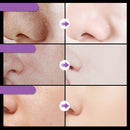 Máscara Facial Removedora de Cravos e Limpeza Profunda da Pele | Davorah